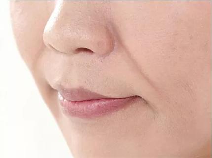 香港SWISSO医学美容旗舰店紧致轮廓效果好吗?真实案例+价格全解