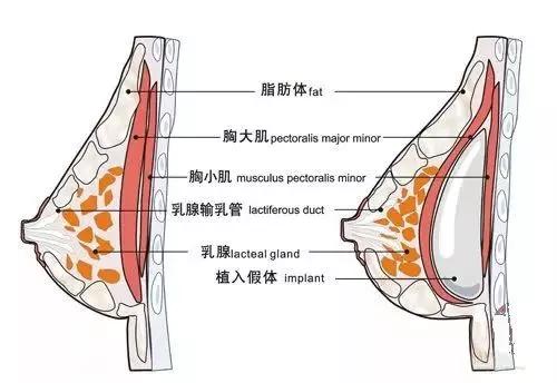 广州奢媛整形医院好不好？价目表更新！医生介绍+隆胸效果图一